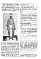 giornale/PUV0041812/1938/V.1/00000651