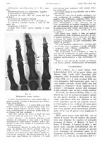 giornale/PUV0041812/1938/V.2/00000314