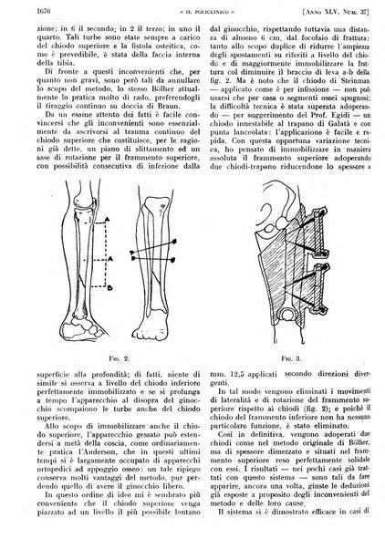 Il policlinico. Sezione pratica periodico di medicina, chirurgia e igiene