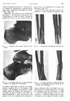 giornale/PUV0041812/1938/V.2/00000377