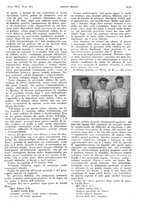giornale/PUV0041812/1938/V.2/00000755