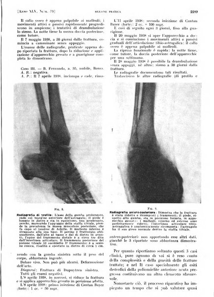 Il policlinico. Sezione pratica periodico di medicina, chirurgia e igiene