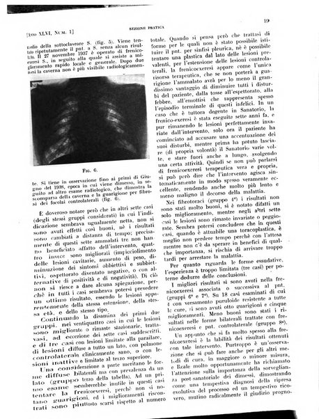 Il policlinico. Sezione pratica periodico di medicina, chirurgia e igiene