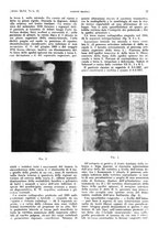 giornale/PUV0041812/1939/unico/00000091