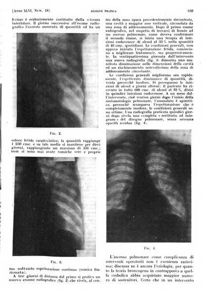 Il policlinico. Sezione pratica periodico di medicina, chirurgia e igiene