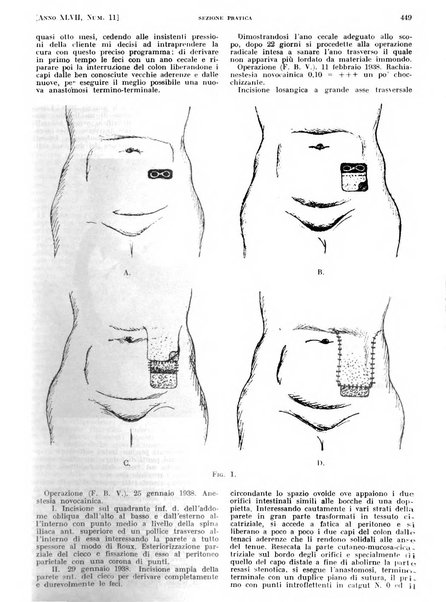 Il policlinico. Sezione pratica periodico di medicina, chirurgia e igiene