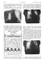 giornale/PUV0041812/1940/unico/00001518