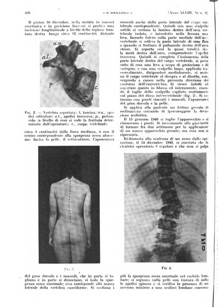 Il policlinico. Sezione pratica periodico di medicina, chirurgia e igiene