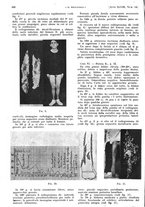giornale/PUV0041812/1941/unico/00000458