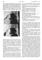 giornale/PUV0041812/1941/unico/00000486