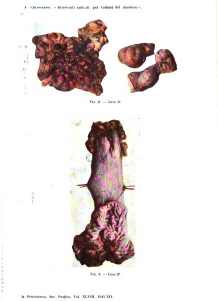 Il policlinico. Sezione pratica periodico di medicina, chirurgia e igiene