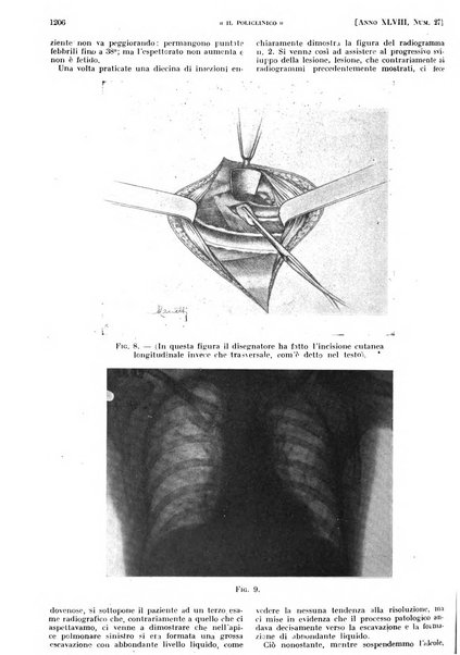 Il policlinico. Sezione pratica periodico di medicina, chirurgia e igiene