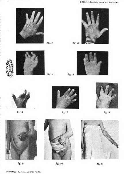 Il policlinico. Sezione pratica periodico di medicina, chirurgia e igiene