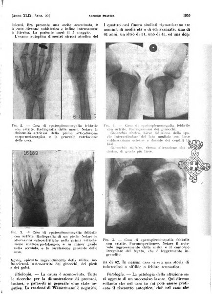 Il policlinico. Sezione pratica periodico di medicina, chirurgia e igiene