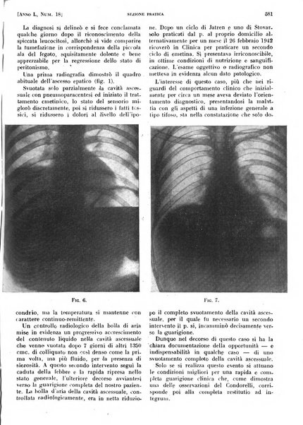 Il policlinico. Sezione pratica periodico di medicina, chirurgia e igiene