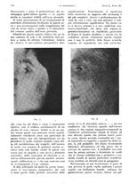 giornale/PUV0041812/1943/V.1/00000612