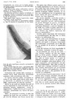 giornale/PUV0041812/1943/V.2/00000551