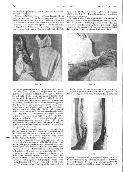 Il policlinico. Sezione pratica periodico di medicina, chirurgia e igiene