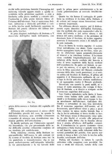 Il policlinico. Sezione pratica periodico di medicina, chirurgia e igiene