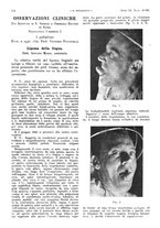 giornale/PUV0041812/1944/unico/00000322