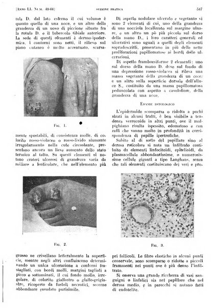 Il policlinico. Sezione pratica periodico di medicina, chirurgia e igiene