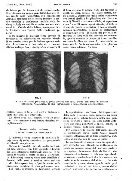 Il policlinico. Sezione pratica periodico di medicina, chirurgia e igiene