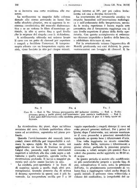 Il policlinico. Sezione pratica periodico di medicina, chirurgia e igiene