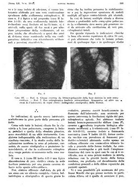 Il policlinico. Sezione pratica periodico di medicina, chirurgia e igiene