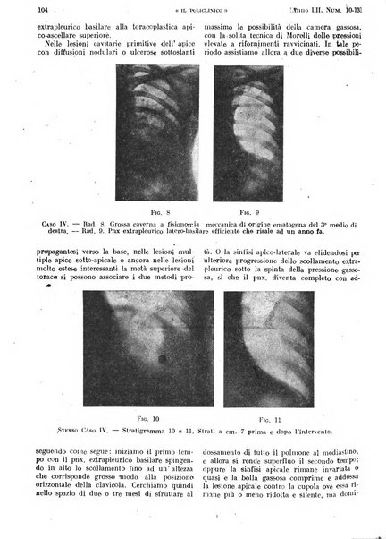 Il policlinico. Sezione pratica periodico di medicina, chirurgia e igiene