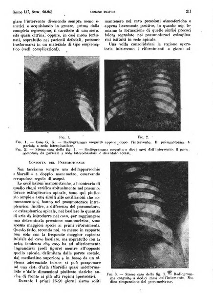 Il policlinico. Sezione pratica periodico di medicina, chirurgia e igiene