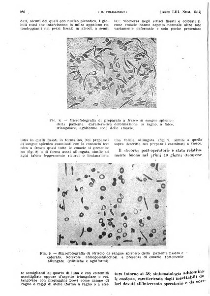 Il policlinico. Sezione pratica periodico di medicina, chirurgia e igiene