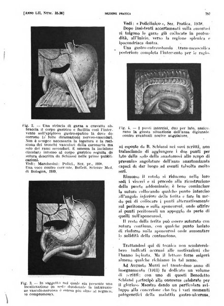 Il policlinico. Sezione pratica periodico di medicina, chirurgia e igiene