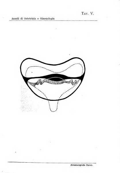 Annali di ostetricia e ginecologia