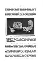 giornale/PUV0109343/1915/V.37.1/00000143