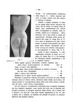giornale/PUV0109343/1915/V.37.2/00000084
