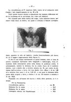 giornale/PUV0109343/1915/V.37.2/00000085