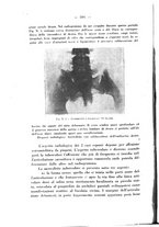 giornale/PUV0109343/1927/unico/00000120