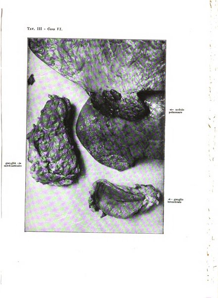 Archivio italiano di anatomia e istologia patologica