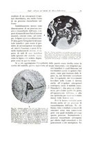giornale/PUV0110165/1935/unico/00000035