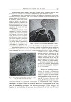 giornale/PUV0110165/1935/unico/00000141