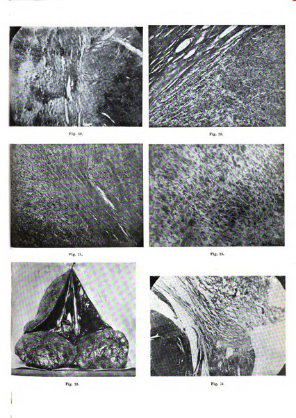 Archivio italiano di anatomia e istologia patologica