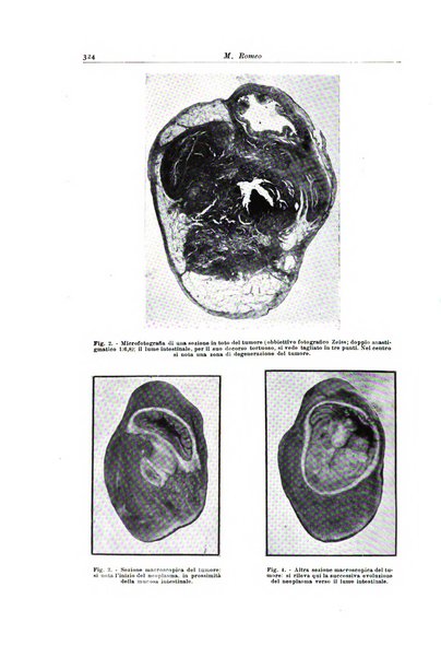 Archivio italiano di anatomia e istologia patologica