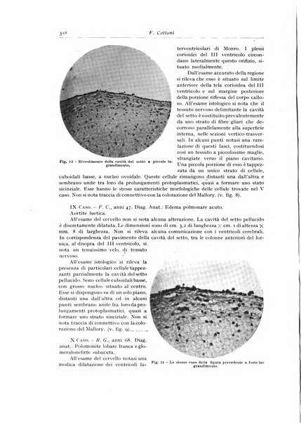 Archivio italiano di anatomia e istologia patologica