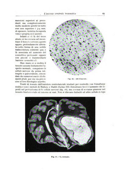 Archivio italiano di anatomia e istologia patologica