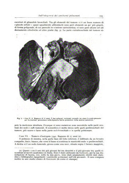 Archivio italiano di anatomia e istologia patologica