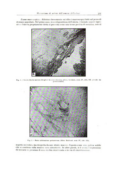 Archivio italiano di anatomia e istologia patologica