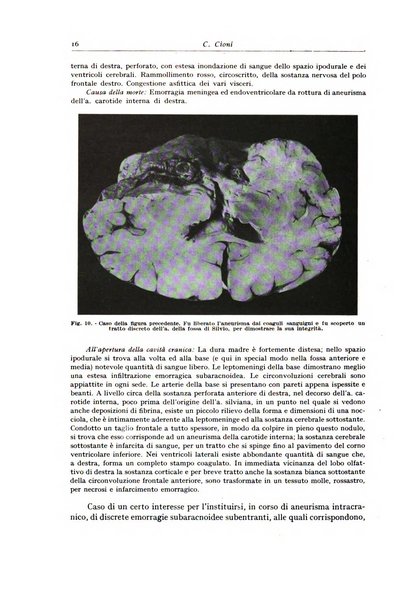 Archivio italiano di anatomia e istologia patologica