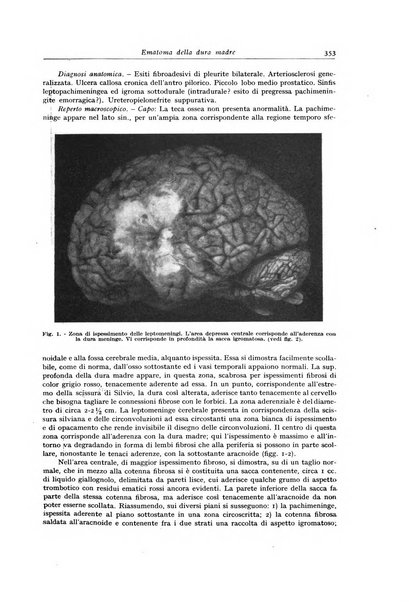 Archivio italiano di anatomia e istologia patologica