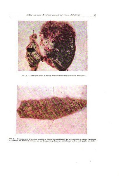 Archivio italiano di anatomia e istologia patologica