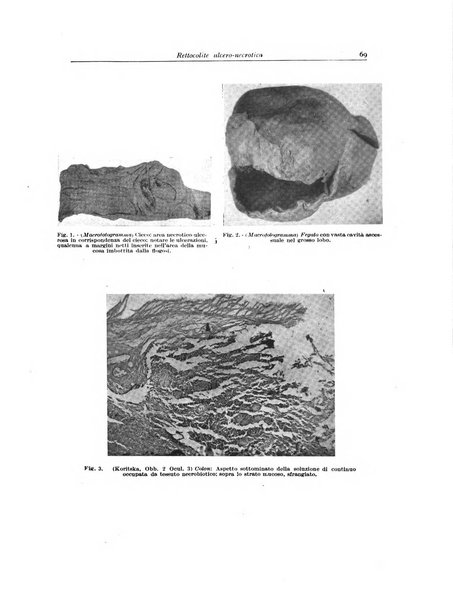 Archivio italiano di anatomia e istologia patologica